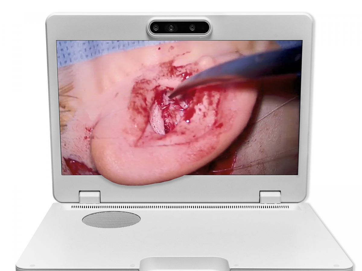 达擎之＂Heads-up 3D显微手术显示系统＂，整合4K裸眼3D显示及眼球追踪系统，具备快速追踪人眼移动位置功能，减轻医师长时间维持固定姿势的负担，让医师能有更宽广清晰的3D立体视野及更舒适的姿势来执行手术。